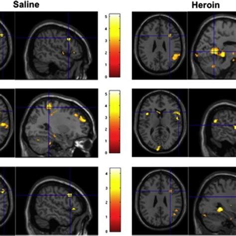 Brain activation during the Go/No–Go task for response inhibition ...