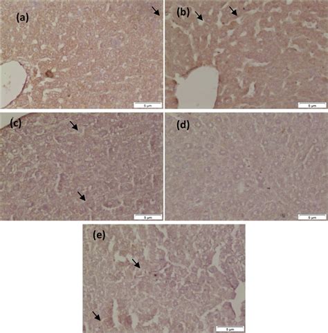 Caspase-3 immunohistochemistry of a liver from (a) control rat showing ...