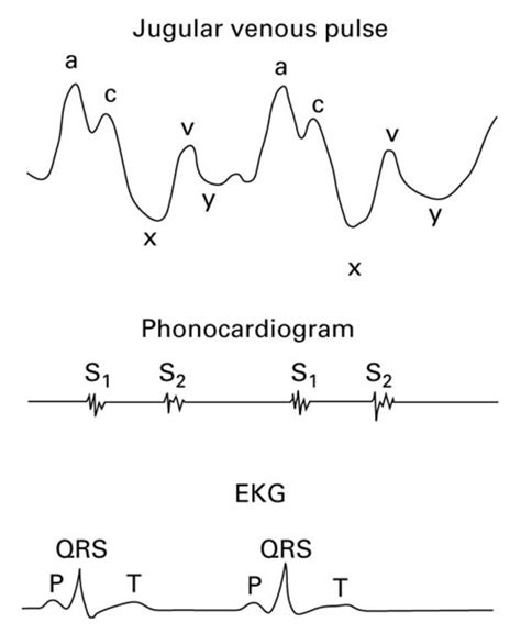 The Jugular Venous Pulse And Hepatojugular Reflux Examinations Of ...