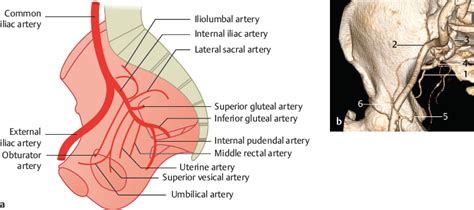 Internal Iliac Artery | Radiology Key