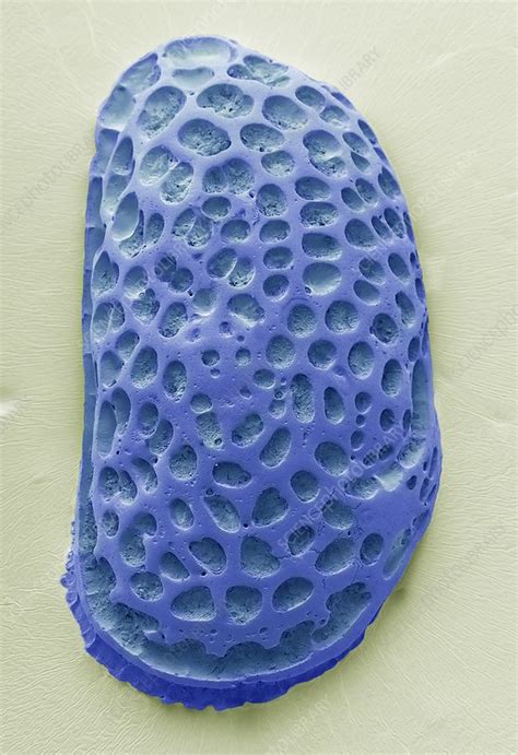 Fossil Ostracod, SEM - Stock Image - C034/5866 - Science Photo Library