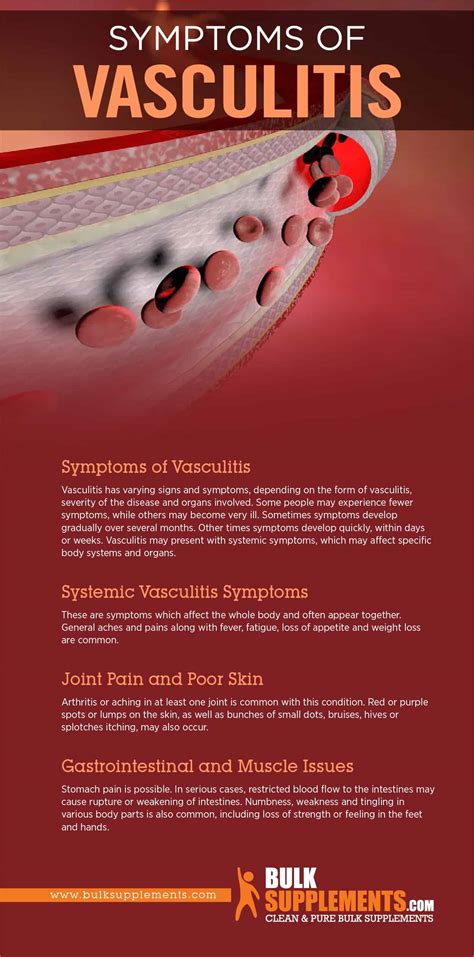 Vasculitis: Symptoms, Causes & Treatment