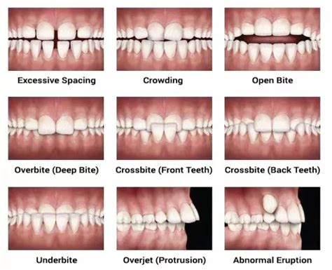 Do it Yourself Orthodontists... - McSurdy Orthodontics