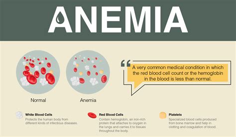 Overview of Anemia: Signs, Symptoms, Causes and Treatment