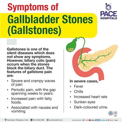 Gallstones, Gallbladder Stones – Symptoms, Causes, Complications