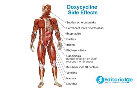 Doxycycline Ruined My Life - Should You Take This Antibiotic?