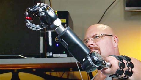 Man Maneuvers Robotic Arm With His Thoughts - Legacy MEDSearch