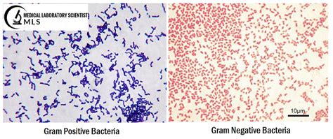 Gram Stain | Lab Tests Guide