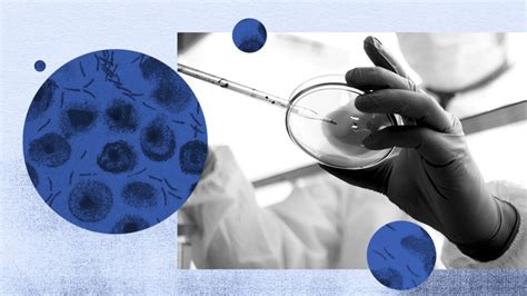 Gram-positive bacteria: Characteristics, treatment, and examples