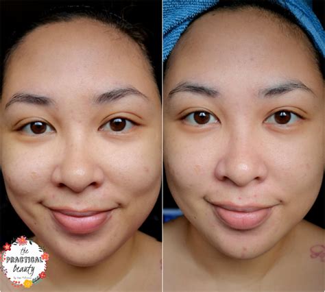 Neobeau Home Clinic Diamond 3-Step Peeling Program | The Practical Beauty