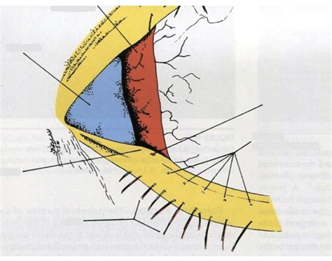 Eye Medial Canthus Anatomy Quiz