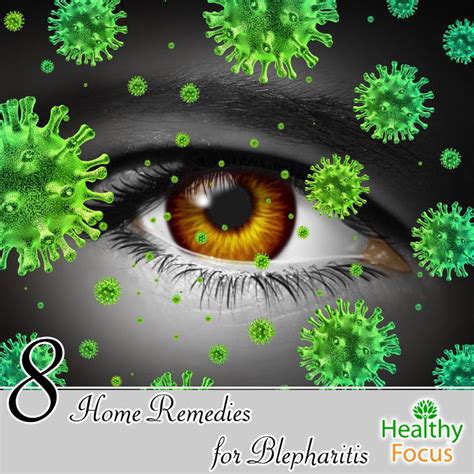 8 Home Remedies for Blepharitis - Healthy Focus