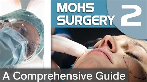 Mohs Surgery: The Gold Standard Treatment for BCC and SCC - YouTube