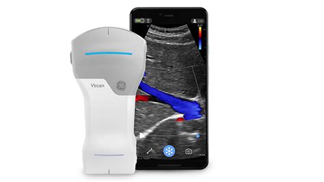 GE Healthcare announces its first wireless portable ultrasound device ...