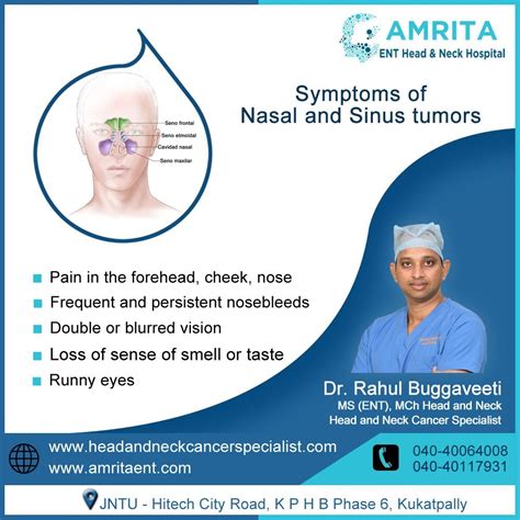 Symptoms of nasal and sinus tumors – Artofit