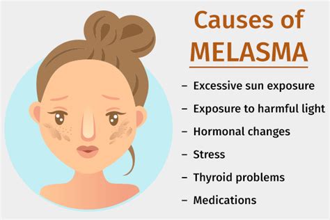 Melasma: Causes, Symptoms, and Medical Treatment