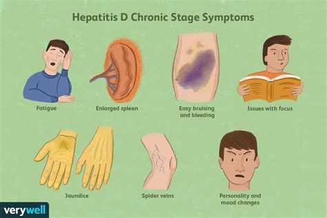 Hepatitis D: Causes, Symptoms, and Cures