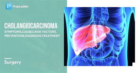 Cholangiocarcinoma: Symptoms, Causes, Risk Factors, Prevention ...