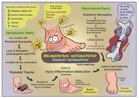 Neuropathic arthropathy: Charcot arthropathy - Creative Med Doses