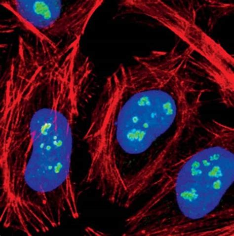 Fibrillarin Monoclonal Antibody (J.99.5), Invitrogen 100 μL ...