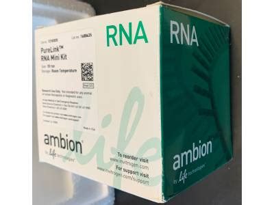 | Labcompare Product Review. Excellent RNA Extraction Kit | Labcompare.com