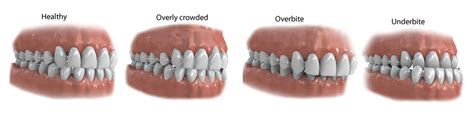 All Categories - Smile Architect Invisible Braces Dental Clinic