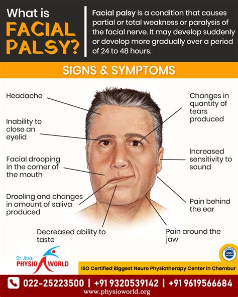 Facial Palsy Signs & Symptoms | Facial nerve, Facial palsy treatment ...