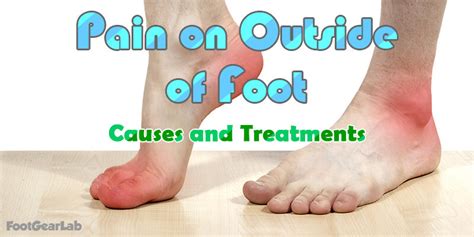 Pain on Outside of Foot: Learn About Its Causes, Diagnosis & Treatment