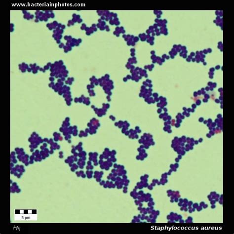 Staphylococcus aureus under microscope: microscopy of Gram-positive ...