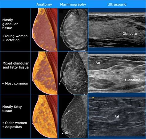 Ultrasound, Ultrasound sonography, Radiology imaging