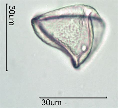 Grass (Family Poaceae) Pollen Under the Microscope