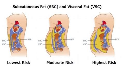 Belly Fat Defined: Subcutaneous Vs Visceral Fat • Bodybuilding Wizard