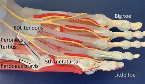 5th Metatarsal Fracture | Dr Ben Beamond | Adelaide