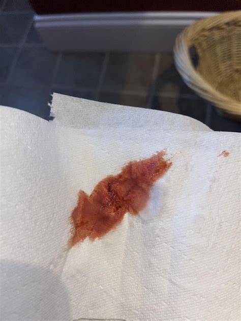 Bright red blood toilet paper 30s : r/shittingadvice