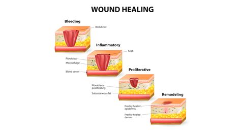 Epithelial Tissue Wound