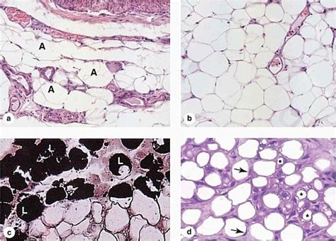 Adipose Tissue Types, Functions, Structure and Location