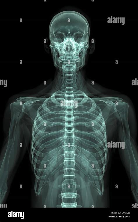 X-Ray image showing the rib cage Stock Photo - Alamy