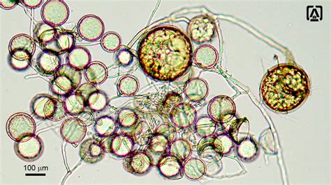 Mycorrhiza