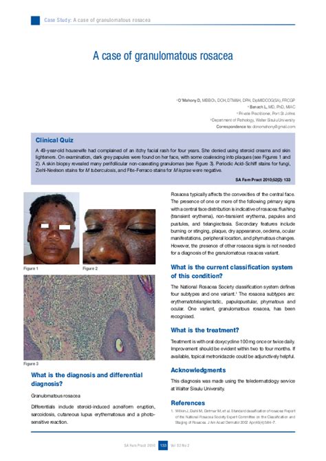 (PDF) A case of granulomatous rosacea | Lech Banach - Academia.edu