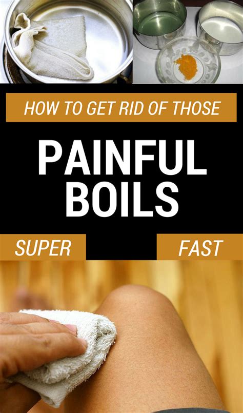 Boils are the result of hair follicles infection given by a poor ...