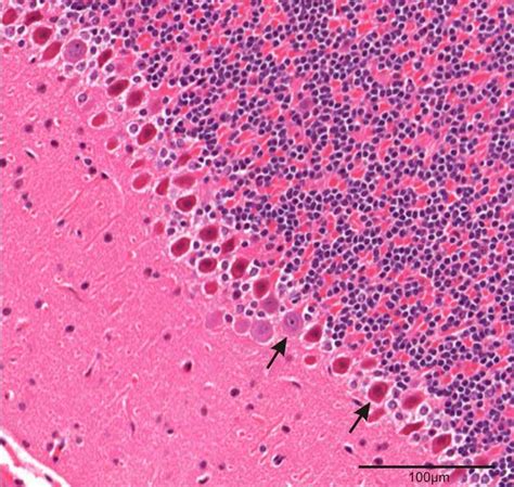 Histology Of Cerebellum Ppt - Human cerebellum @ 40x showing the ...