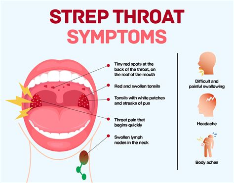 White Spots On Tonsils Not Strep