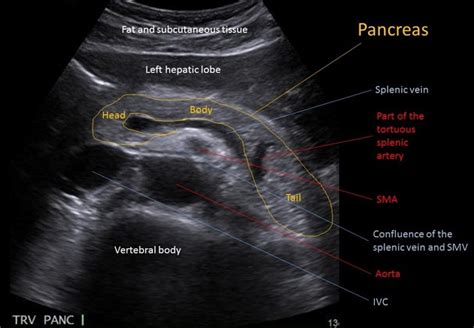 Cours US Abdomen - Pancréas