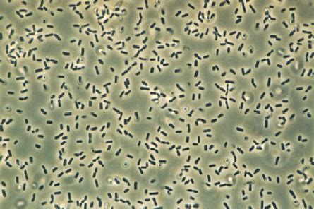 Bacillus Subtilis Shape, Gram Stain, & Arrangement | Is Bacillus ...