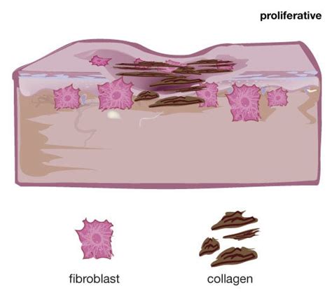 The 3 Stages Of Wound Healing - Podiatry HQ Clinics