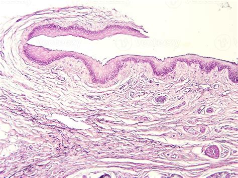 histology human tissue with microscope from laboratory 27222479 Stock ...