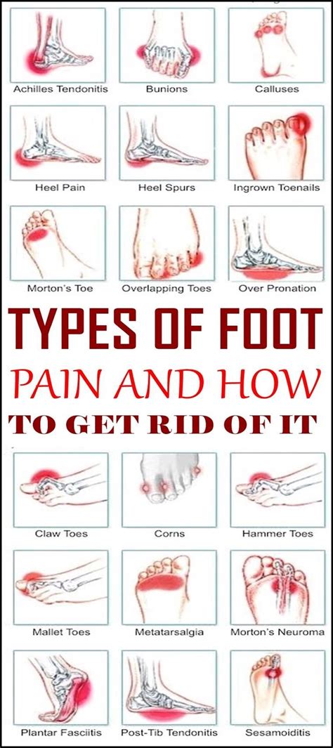 Foot Pain Diagnosis Symptoms Bottom Of Foot