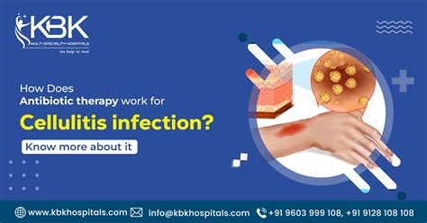 How Does Antibiotic therapy work for cellulitis infection? Learn now