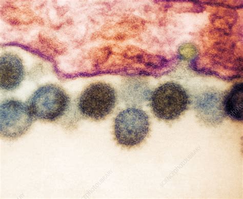 Crimean-Congo haemorrhagic fever virus - Stock Image - M050/0812 ...