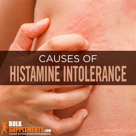 Histamine Intolerance: Signs, Causes & Treatment